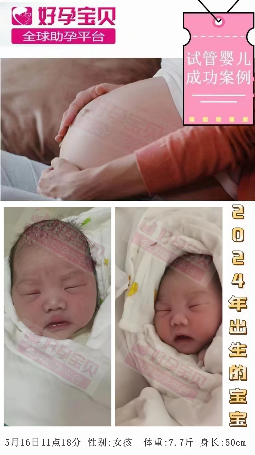 希宇助孕机构：每个孕妈妈都有可能生育唐氏儿~