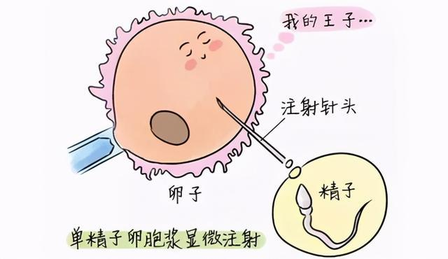 试管婴儿：为什么着床率≠成功率？